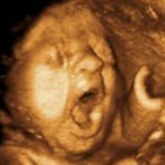 4 Dimenziós ultrahang vizsgálat - babamozi